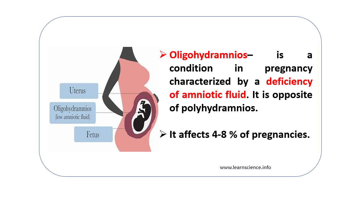 Oligohydramnios - BioPharma Notes